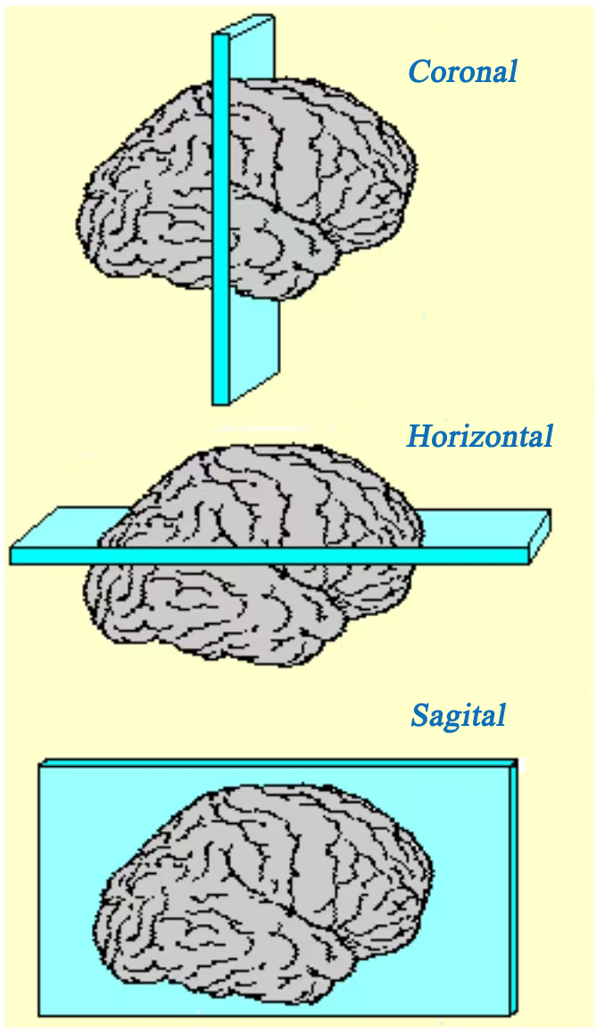 Brain Matrix